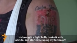 Ukrainian Miner Describes Torture In Rebel Captivity