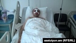 Armenia - Hayk Khanumian, an opposition parliamentarian, recovers in a hospital in Stepanakert after being attacked by unknown men, June 6, 2016